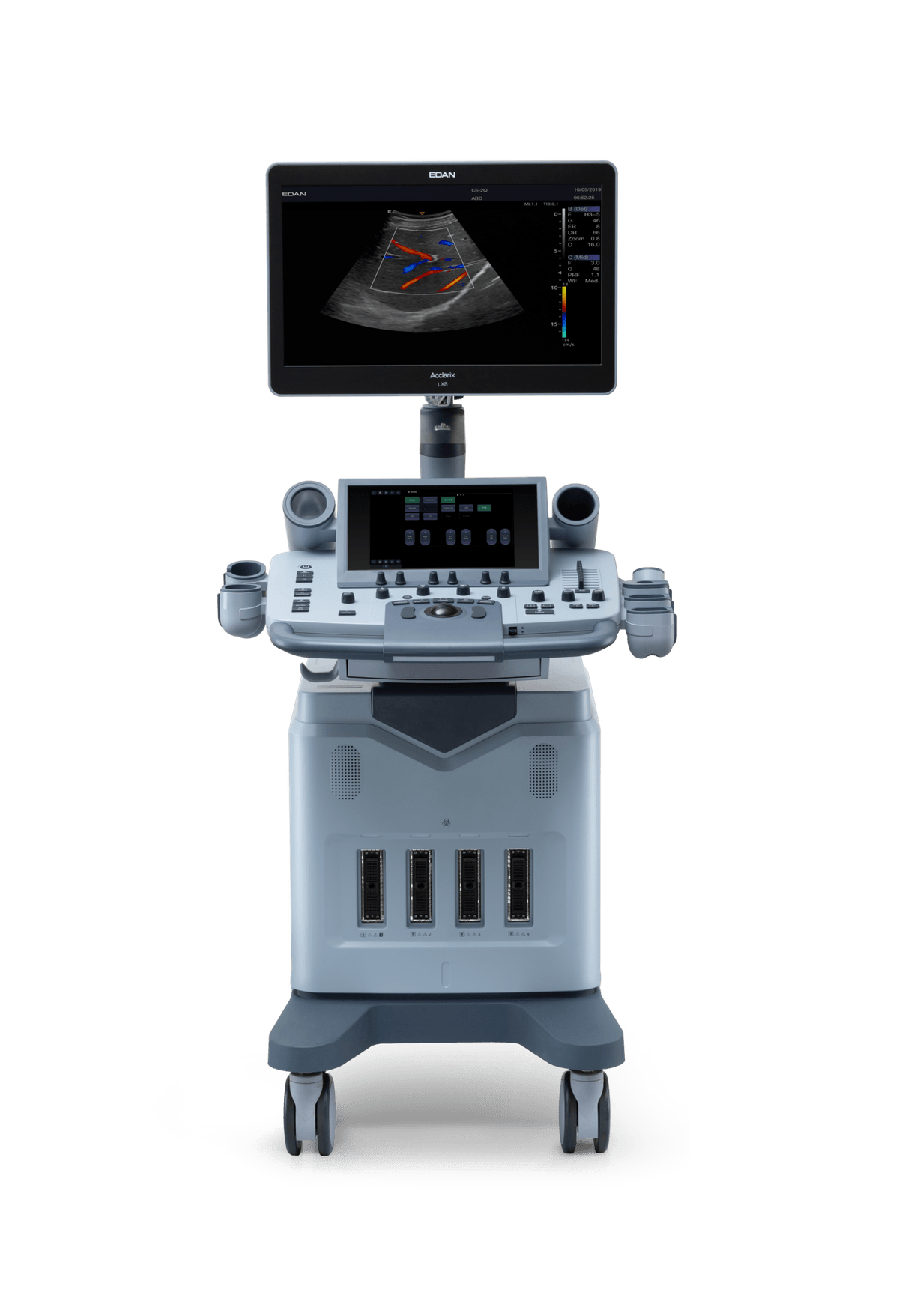 Acclarix LX8 Ultrasound System - Picture 2